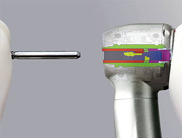 Turbine NSK Ti-Max Z900L : griffe bouton-poussoir